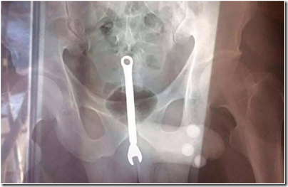 Фото: https://cdn-tn.fishki.net/26/preview/3550209.jpg image